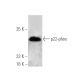 p22-phox Antibody (E-11) - Western Blotting - Image 388949 
