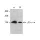 p22-phox Antibody (E-8) - Western Blotting - Image 377116