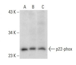 western blotting image from recommended p22-phox (E-11) monoclonal antibody replacement. Image 137632