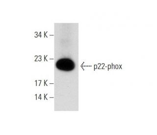 p22-phox Antibody (44.1) - Western Blotting - Image 62248 