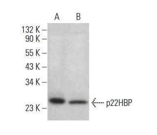 p22HBP Antibody (B-3) - Western Blotting - Image 383969Each CRISPR/Cas9 Knockout (KO) Plasmid product consists of a pool of 3 plasmids designed to ensure identification and cleavage of a specific gene for maximum knockout efficiency. Each plasmid encodes a unique 20 nt sequence derived from the GeCKO (v2) library.