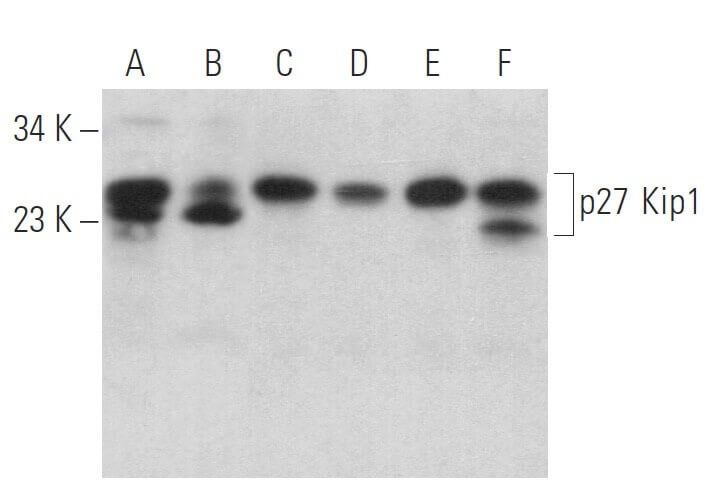 p27 Kip1 Antibody (C-19) | SCBT - Santa Cruz Biotechnology