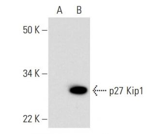 CDKN1B/Kip1 p27 Antibody (D-2) - Western Blotting - Image 294541