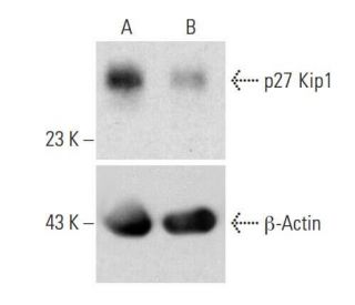 CDKN1B/Kip1 p27 Antibody (F-8) | SCBT - Santa Cruz Biotechnology