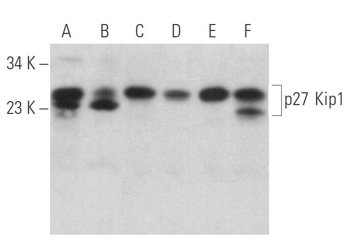CDKN1B/Kip1 p27 Antibody (F-8) | SCBT - Santa Cruz Biotechnology