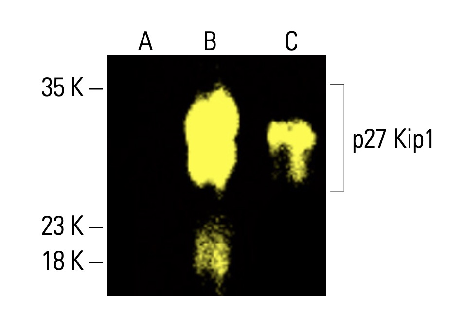 CDKN1B/Kip1 p27抗体(F-8) | SCBT - Santa Cruz Biotechnology CDKN1B/Kip1 p27抗体(F-8) | SCBT - Santa Cruz Biotechnology