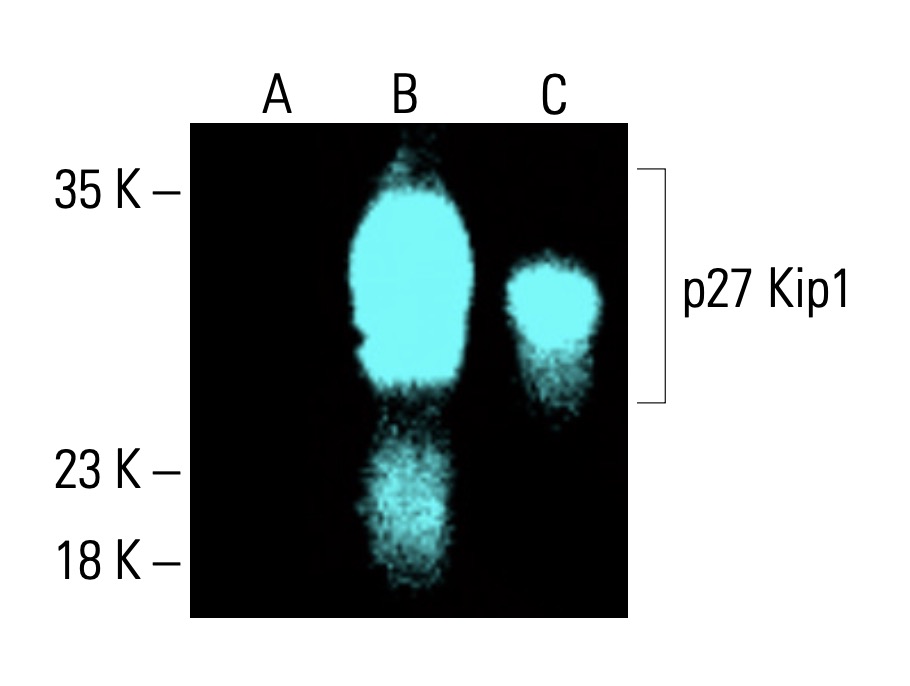 CDKN1B/Kip1 p27 Antibody (F-8) | SCBT - Santa Cruz Biotechnology