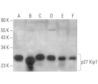 CDKN1B/Kip1 p27 Antibody (SX53G8.5) - Western Blotting - Image 349953 