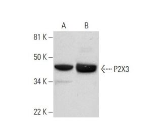 western blotting image from recommended P2X3 (B-5) monoclonal antibody replacement. Image 295826