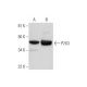 western blotting image from recommended P2X3 (B-5) monoclonal antibody replacement. Image 295826
