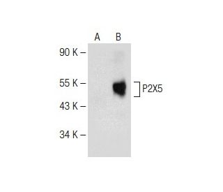 P2X5 Antibody (C-2) - Western Blotting - Image 147979 