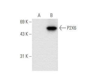 P2X6 Antibody (E-9) - Western Blotting - Image 65792