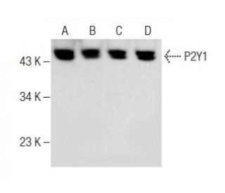 western blotting image from recommended P2Y1 (E-1) monoclonal antibody replacement. Image 283475
