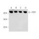 P2Y1 Antibody (E-1) - Western Blotting - Image 283475 