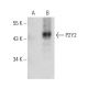 This polyclonal antibody has been discontinued. See our recommended <a href="p2y2-antibody-e-3">P2Y2 (E-3)</a> monoclonal antibody (sample data shown). western blotting image from recommended P2Y2 (E-3) monoclonal antibody replacement. Image 385936