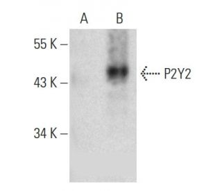 western blotting image from recommended P2Y2 (E-3) monoclonal antibody replacement. Image 385936