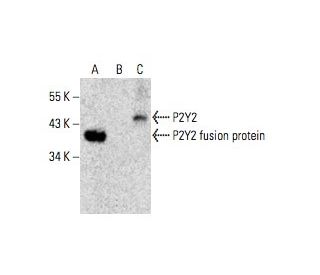 P2Y2 Antibody (H-5) - Western Blotting - Image 396360Each CRISPR/Cas9 Knockout (KO) Plasmid product consists of a pool of 3 plasmids designed to ensure identification and cleavage of a specific gene for maximum knockout efficiency. Each plasmid encodes a unique 20 nt sequence derived from the GeCKO (v2) library.