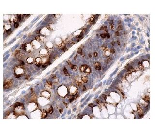 immunohistochemistry image from recommended p300 (F-4) monoclonal antibody replacement. Image 156757
