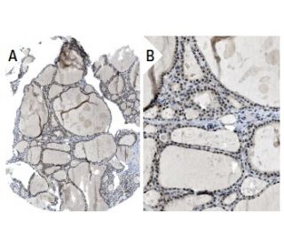 p33ING1 Antibody (CAb 3) - Immunohistochemistry - Image 37950 