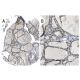 p33ING1 Antibody (CAb 3) - Immunohistochemistry - Image 37950 