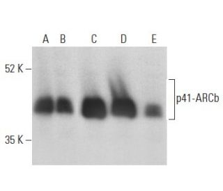 p41-ARCb Antibody (C-3) - Western Blotting - Image 399138 