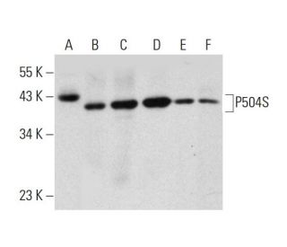 P504S Antibody (H-2) - Western Blotting - Image 320462 