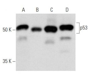 p53 Antibody (2B2.68) - Western Blotting - Image 354298 