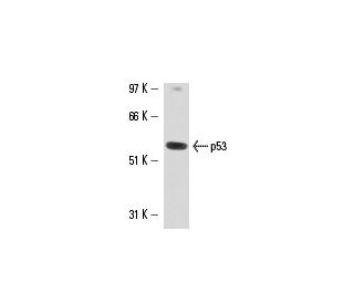 p53 Antibody (2Q366) - Western Blotting - Image 15833 