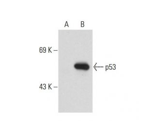 p53 Antibody (2Q375) - Western Blotting - Image 127630 