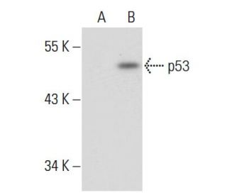 p53 Antibody (3H2821) - Western Blotting - Image 48939 