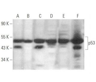 p53 Antibody (BP 53.12) - Western Blotting - Image 349925 