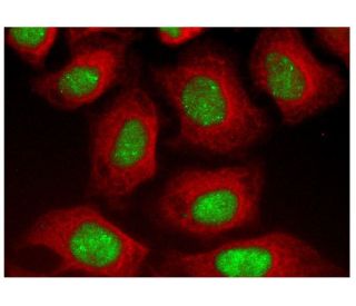 p53 Monoclonal Antibody (X77) (MA1-12549)