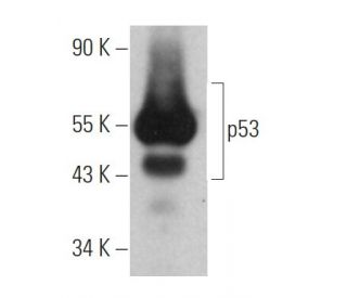 p53 Antibody (DO-7) | SCBT - Santa Cruz Biotechnology