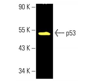 p53 Monoclonal Antibody (X77) (MA1-12549)