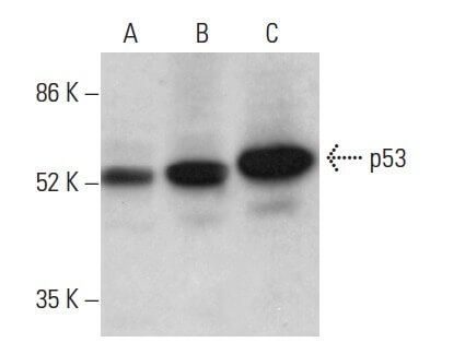 Tri-Methyl-Histone H3 (Lys36) (D5A7) XP® Rabbit mAb (BSA and