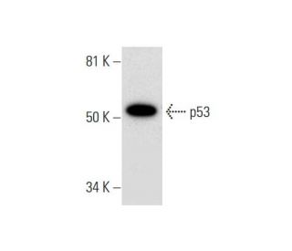 western blotting image from recommended p53 (A-1) monoclonal antibody replacement. Image 291953