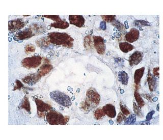 p53 Antibody (Pab 1801) - Immunohistochemistry - Image 160137 