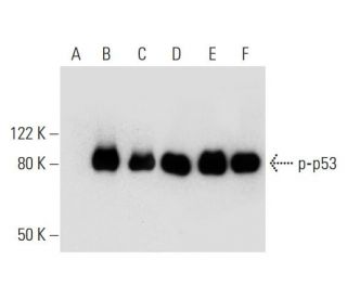 p53 Antibody (Pab 240) - Western Blotting - Image 294675 
