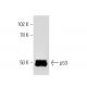 p53 Antibody (Pab 246) - Western Blotting - Image 17 
