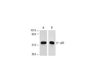 p53 Antibody (Bp53-12) - Western Blotting - Image 3 