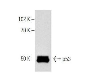 p53 Antibody (Pab 246) - Western Blotting - Image 17 