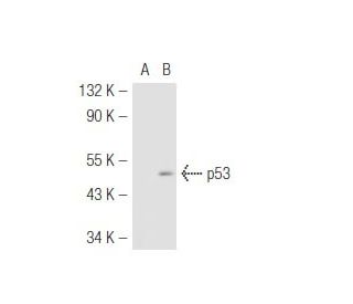 p53 (2B2.73): sc-71816. Western blot analysis of p53 expression in... 