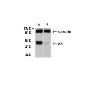 p53 siRNA (h): sc-29435. Western blot analysis of p53 expression in control non-transfected (A) and p53 siRNA transfected 
