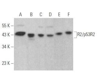 western blotting image from recommended R2/p53R2 (F-9) monoclonal antibody replacement. Image 354429