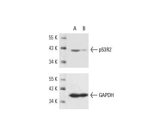 p53R2 siRNA (h): sc-36158. Western blot analysis of p53R2 expression in non-transfected control (A) and p53R2 siRNA transf 