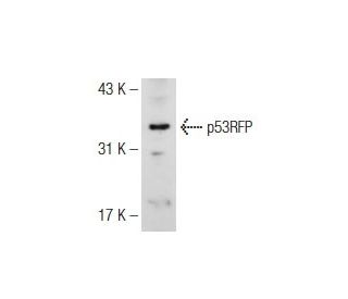 p53RFP Antibody (U-16) - Western Blotting - Image 126912 