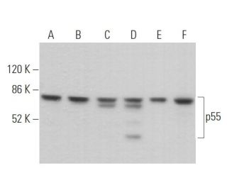 p55 Antibody (A-7) - Western Blotting - Image 373535 