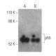 p55 Antibody (A-7) - Western Blotting - Image 401212