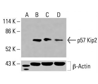 p57 Kip2 Antibody (H-12) - Western Blotting - Image 416121