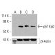 p57 Kip2 Antikörper (H-12): sc-515909. Western Blot Analyse der p57 Kip2 Expression in unbehandelten HeLa- (A), chemisch behandelten HeLa- (B), K-562- (C) und HCT-116- (D) Gesamtzelllysaten. Verwendetes Nachweisreagenz: m-IgGκ BP-HRP: sc-516102. β-Actin (C4): sc-47778 als Ladekontrolle verwendet. Verwendetes Nachweisreagenz: m-IgG Fc BP-HRP: sc-525409. p57 Kip2 Antibody (H-12) - Western Blotting - Image 416121